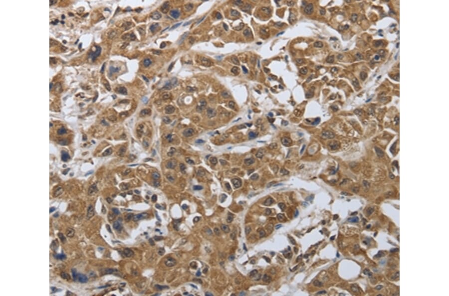 Immunohistochemistry - MYH11 Antibody from Signalway Antibody (37037) - Antibodies.com