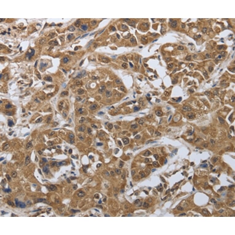 Immunohistochemistry - MYH11 Antibody from Signalway Antibody (37037) - Antibodies.com