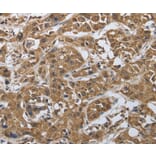 Immunohistochemistry - MYH11 Antibody from Signalway Antibody (37037) - Antibodies.com