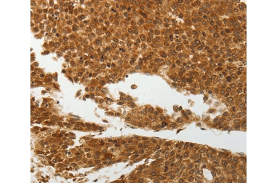 Immunohistochemistry - SOCS7 Antibody from Signalway Antibody (37039) - Antibodies.com