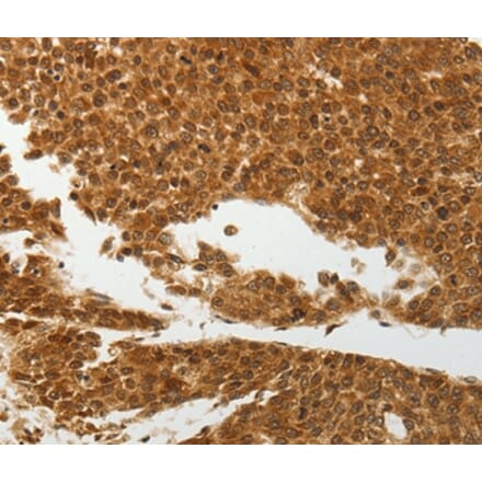 Immunohistochemistry - SOCS7 Antibody from Signalway Antibody (37039) - Antibodies.com