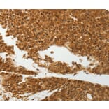 Immunohistochemistry - SOCS7 Antibody from Signalway Antibody (37039) - Antibodies.com