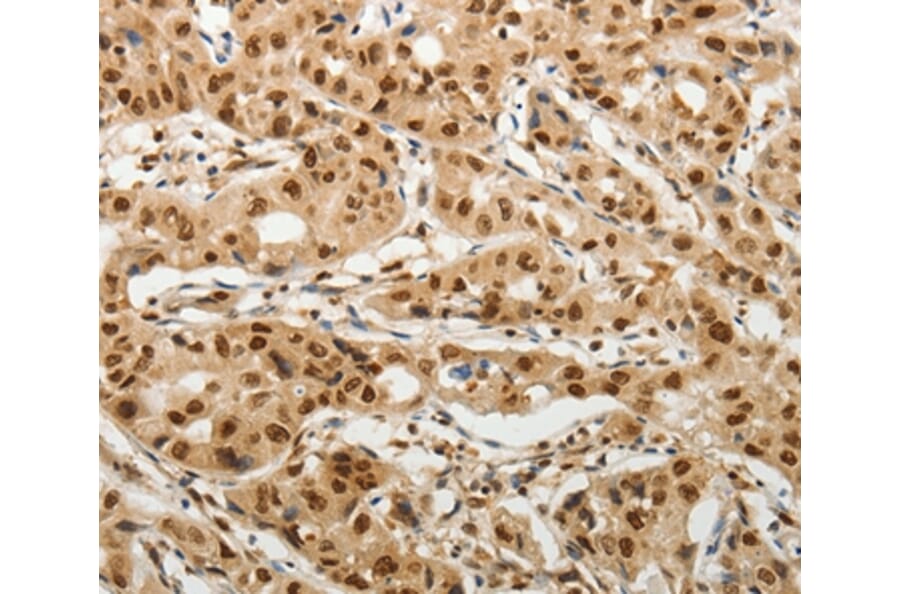 Immunohistochemistry - SOCS7 Antibody from Signalway Antibody (37039) - Antibodies.com