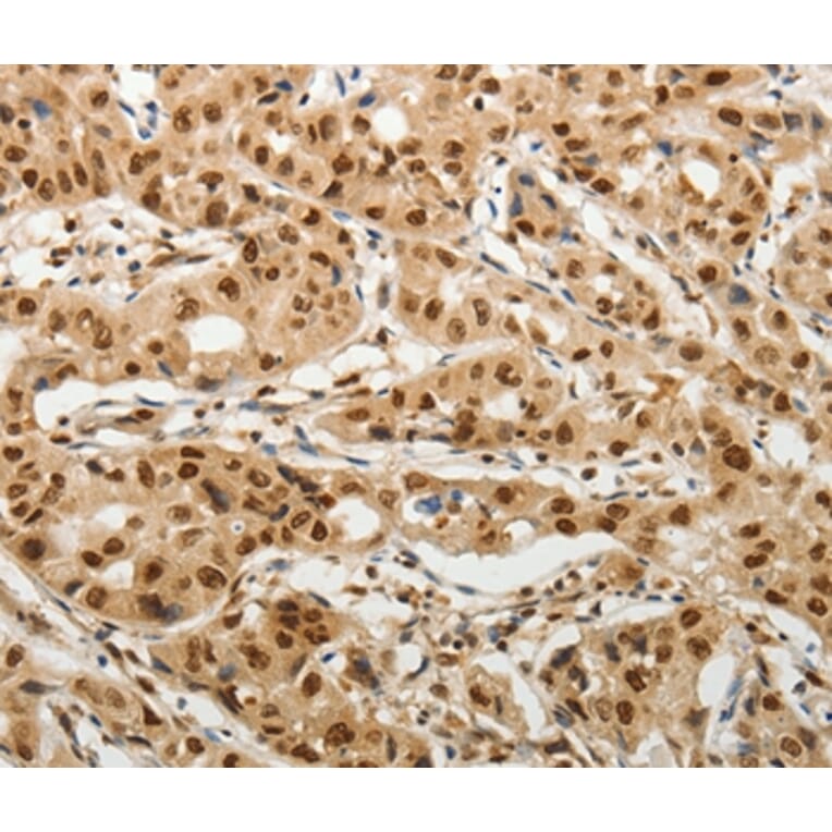 Immunohistochemistry - SOCS7 Antibody from Signalway Antibody (37039) - Antibodies.com