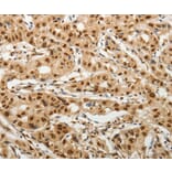 Immunohistochemistry - SOCS7 Antibody from Signalway Antibody (37039) - Antibodies.com