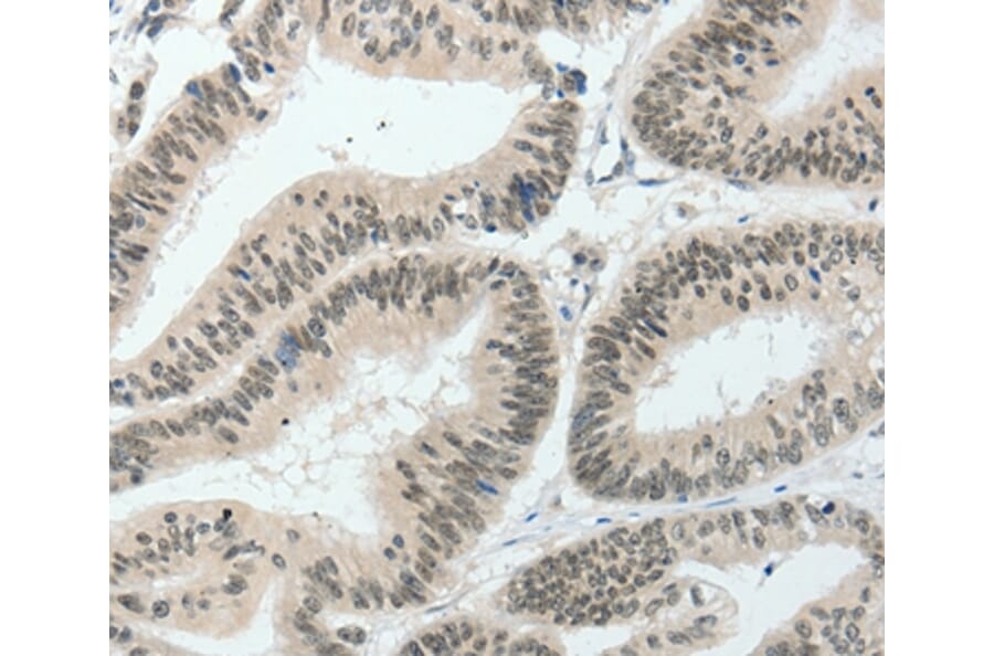 Immunohistochemistry - HNF1B Antibody from Signalway Antibody (37050) - Antibodies.com