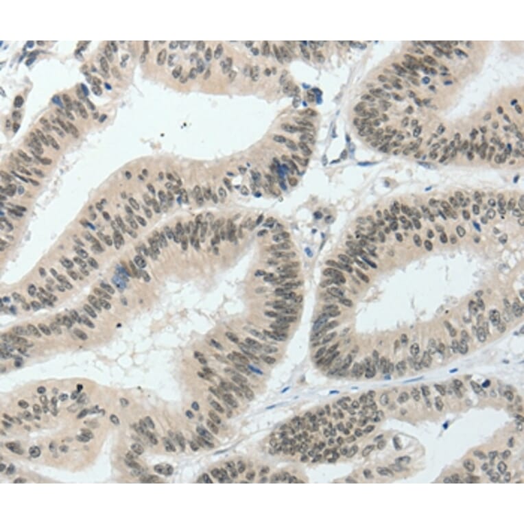 Immunohistochemistry - HNF1B Antibody from Signalway Antibody (37050) - Antibodies.com