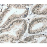 Immunohistochemistry - HNF1B Antibody from Signalway Antibody (37050) - Antibodies.com