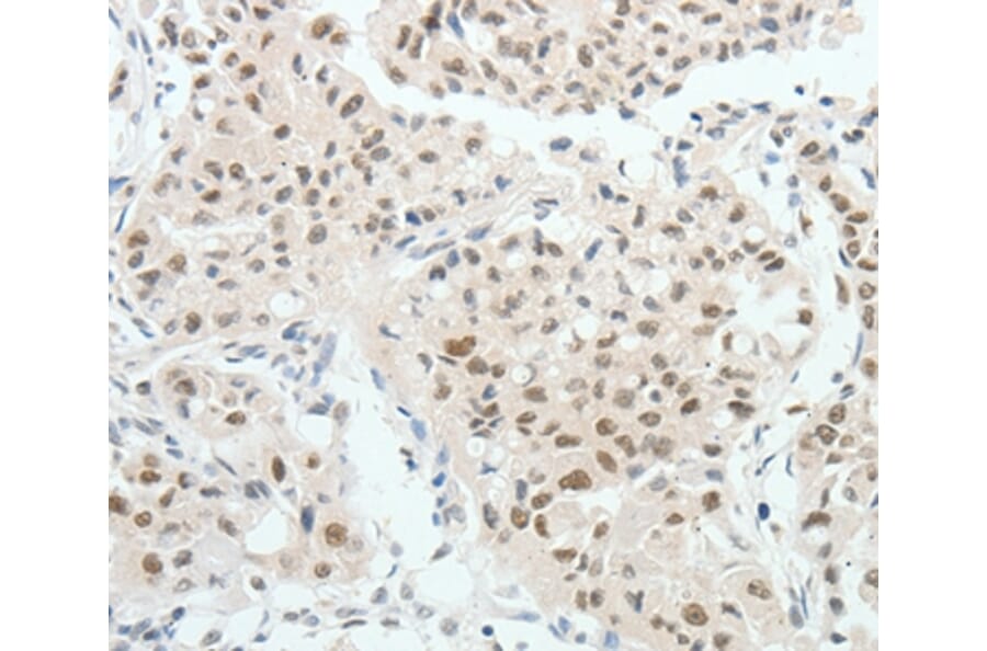Immunohistochemistry - HNF1B Antibody from Signalway Antibody (37050) - Antibodies.com