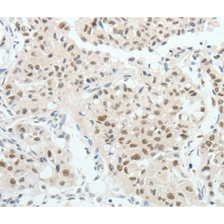 Immunohistochemistry - HNF1B Antibody from Signalway Antibody (37050) - Antibodies.com