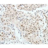 Immunohistochemistry - HNF1B Antibody from Signalway Antibody (37050) - Antibodies.com