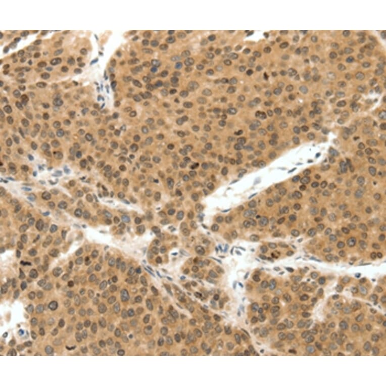 Immunohistochemistry - TERF2 Antibody from Signalway Antibody (37055) - Antibodies.com