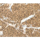 Immunohistochemistry - TERF2 Antibody from Signalway Antibody (37055) - Antibodies.com