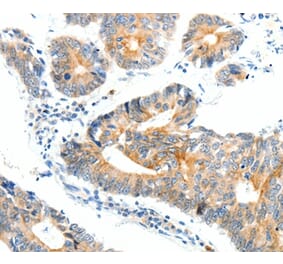 Immunohistochemistry - NTRK1 Antibody from Signalway Antibody (37056) - Antibodies.com