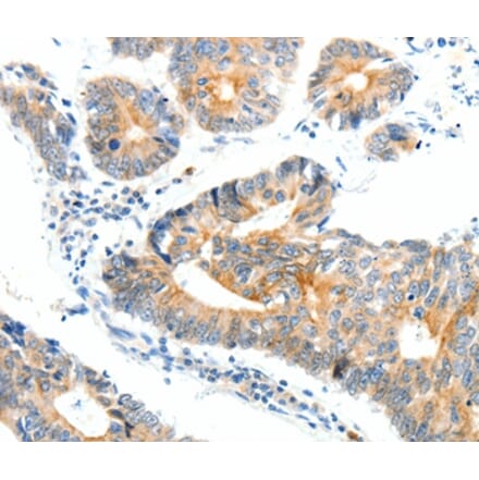 Immunohistochemistry - NTRK1 Antibody from Signalway Antibody (37056) - Antibodies.com