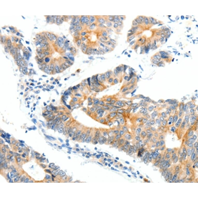 Immunohistochemistry - NTRK1 Antibody from Signalway Antibody (37056) - Antibodies.com