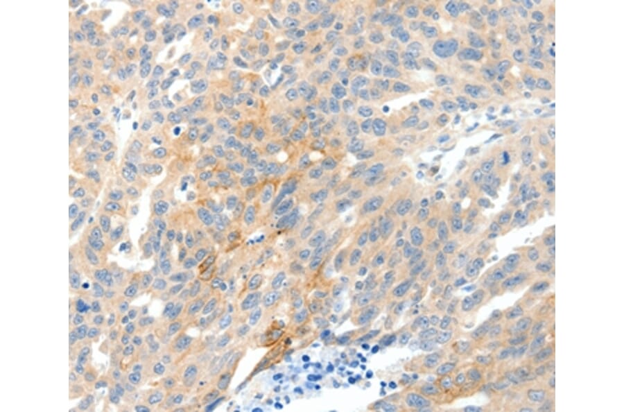 Immunohistochemistry - NTRK1 Antibody from Signalway Antibody (37056) - Antibodies.com