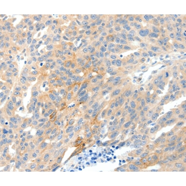 Immunohistochemistry - NTRK1 Antibody from Signalway Antibody (37056) - Antibodies.com