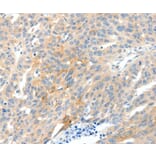 Immunohistochemistry - NTRK1 Antibody from Signalway Antibody (37056) - Antibodies.com