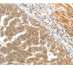 Immunohistochemistry - LPAR5 Antibody from Signalway Antibody (37063) - Antibodies.com
