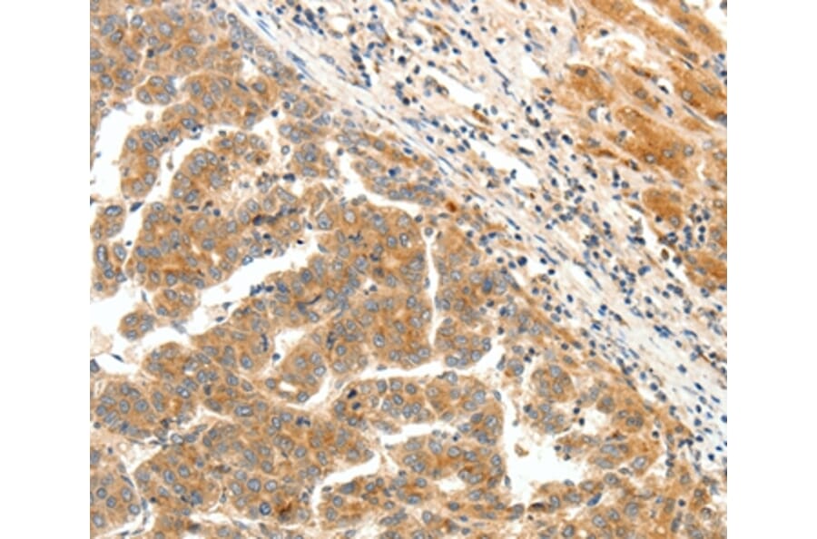 Immunohistochemistry - LPAR5 Antibody from Signalway Antibody (37063) - Antibodies.com
