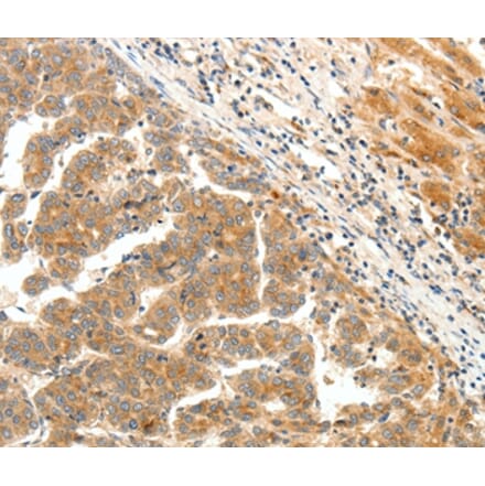 Immunohistochemistry - LPAR5 Antibody from Signalway Antibody (37063) - Antibodies.com