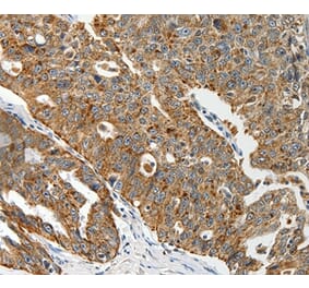 Immunohistochemistry - ABCD2 Antibody from Signalway Antibody (37073) - Antibodies.com