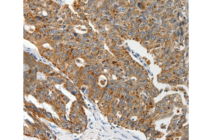 Immunohistochemistry - ABCD2 Antibody from Signalway Antibody (37073) - Antibodies.com