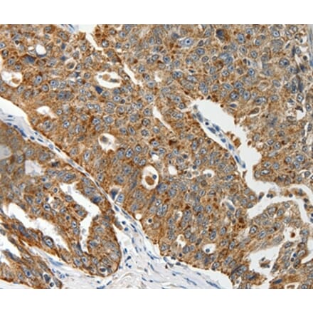 Immunohistochemistry - ABCD2 Antibody from Signalway Antibody (37073) - Antibodies.com