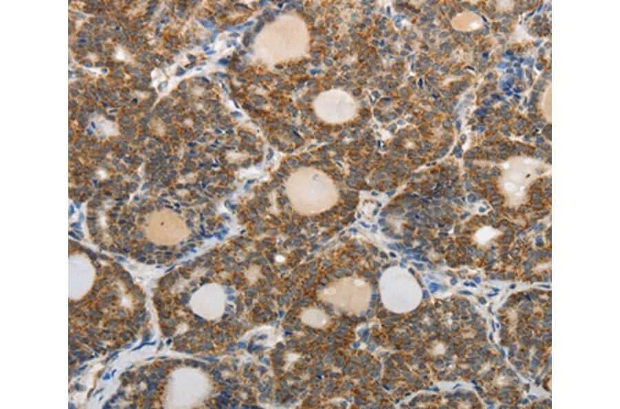 Immunohistochemistry - ABCD2 Antibody from Signalway Antibody (37073) - Antibodies.com