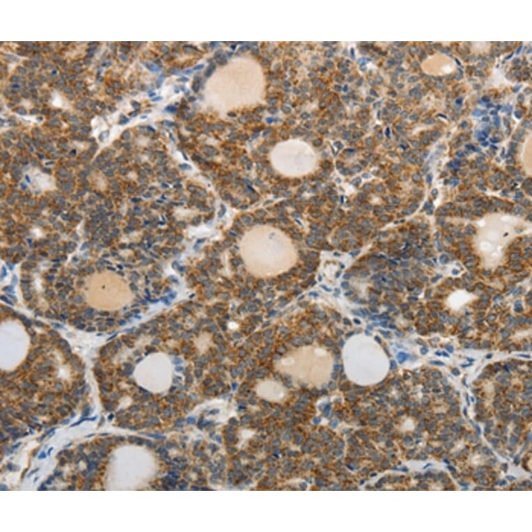 Immunohistochemistry - ABCD2 Antibody from Signalway Antibody (37073) - Antibodies.com