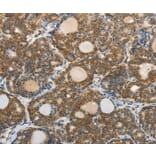 Immunohistochemistry - ABCD2 Antibody from Signalway Antibody (37073) - Antibodies.com