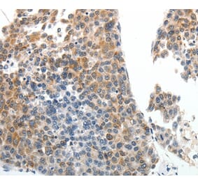 Immunohistochemistry - ABCG5 Antibody from Signalway Antibody (37075) - Antibodies.com