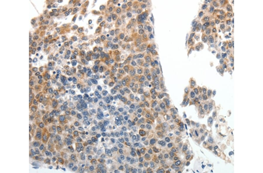 Immunohistochemistry - ABCG5 Antibody from Signalway Antibody (37075) - Antibodies.com