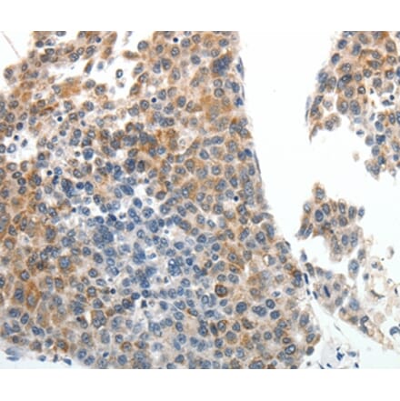 Immunohistochemistry - ABCG5 Antibody from Signalway Antibody (37075) - Antibodies.com