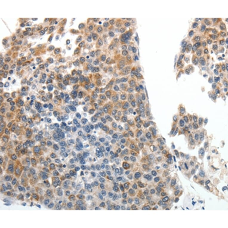 Immunohistochemistry - ABCG5 Antibody from Signalway Antibody (37075) - Antibodies.com