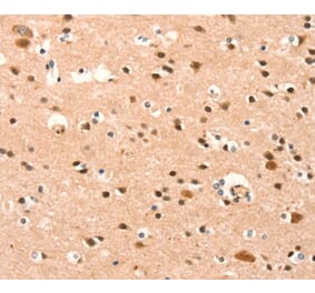 Immunohistochemistry - BAZ1A Antibody from Signalway Antibody (37079) - Antibodies.com