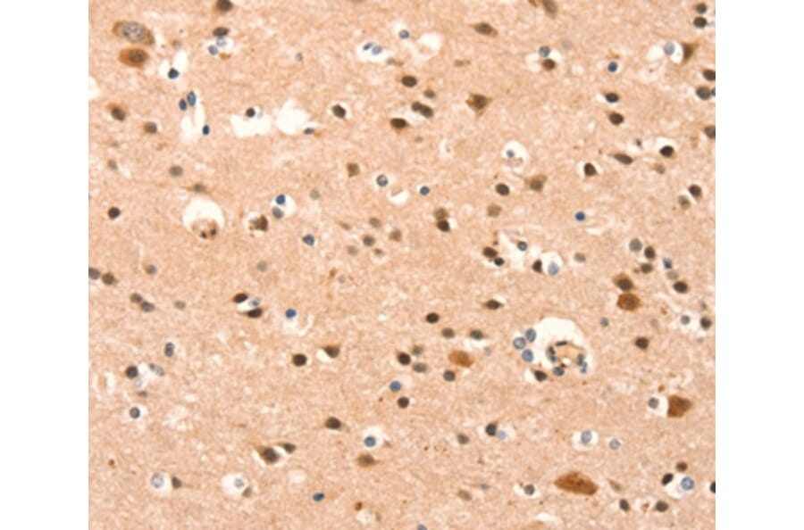 Immunohistochemistry - BAZ1A Antibody from Signalway Antibody (37079) - Antibodies.com