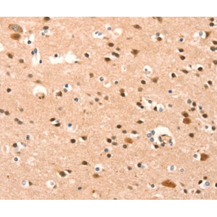 Immunohistochemistry - BAZ1A Antibody from Signalway Antibody (37079) - Antibodies.com