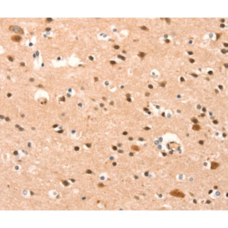 Immunohistochemistry - BAZ1A Antibody from Signalway Antibody (37079) - Antibodies.com