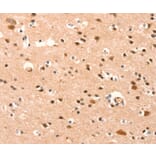 Immunohistochemistry - BAZ1A Antibody from Signalway Antibody (37079) - Antibodies.com