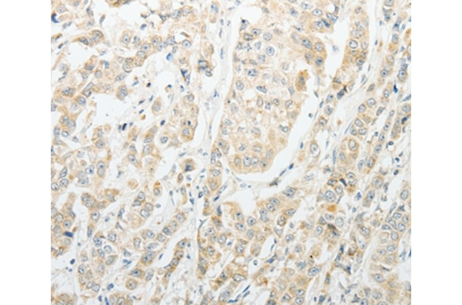 Immunohistochemistry - AGBL1 Antibody from Signalway Antibody (37089) - Antibodies.com