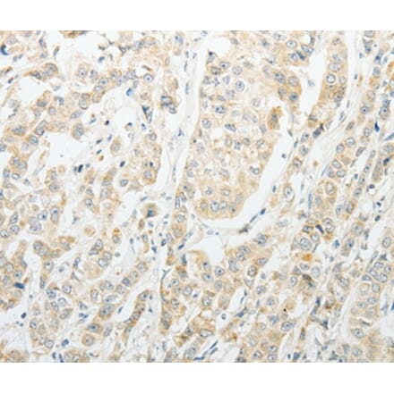 Immunohistochemistry - AGBL1 Antibody from Signalway Antibody (37089) - Antibodies.com