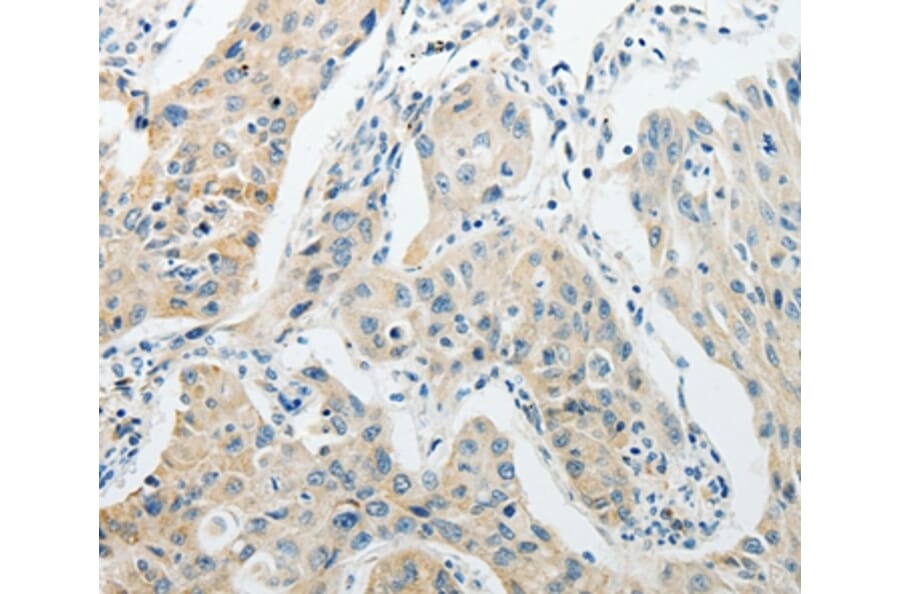 Immunohistochemistry - AGBL1 Antibody from Signalway Antibody (37089) - Antibodies.com
