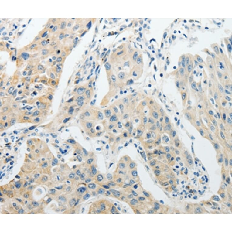 Immunohistochemistry - AGBL1 Antibody from Signalway Antibody (37089) - Antibodies.com