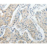 Immunohistochemistry - AGBL1 Antibody from Signalway Antibody (37089) - Antibodies.com