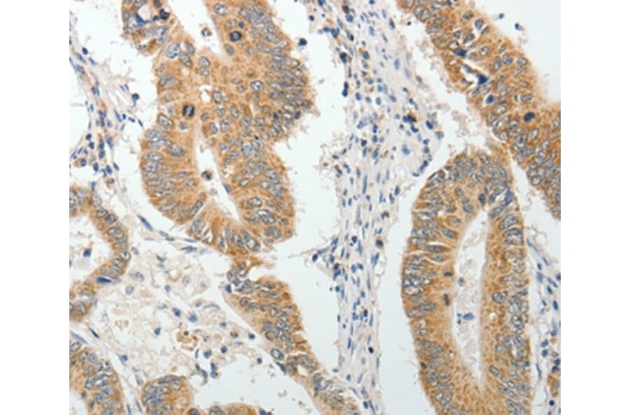 Immunohistochemistry - AKAP1 Antibody from Signalway Antibody (37094) - Antibodies.com