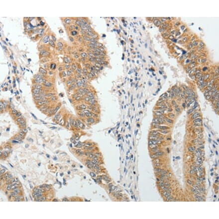 Immunohistochemistry - AKAP1 Antibody from Signalway Antibody (37094) - Antibodies.com