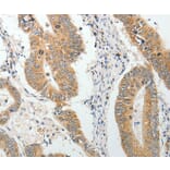 Immunohistochemistry - AKAP1 Antibody from Signalway Antibody (37094) - Antibodies.com