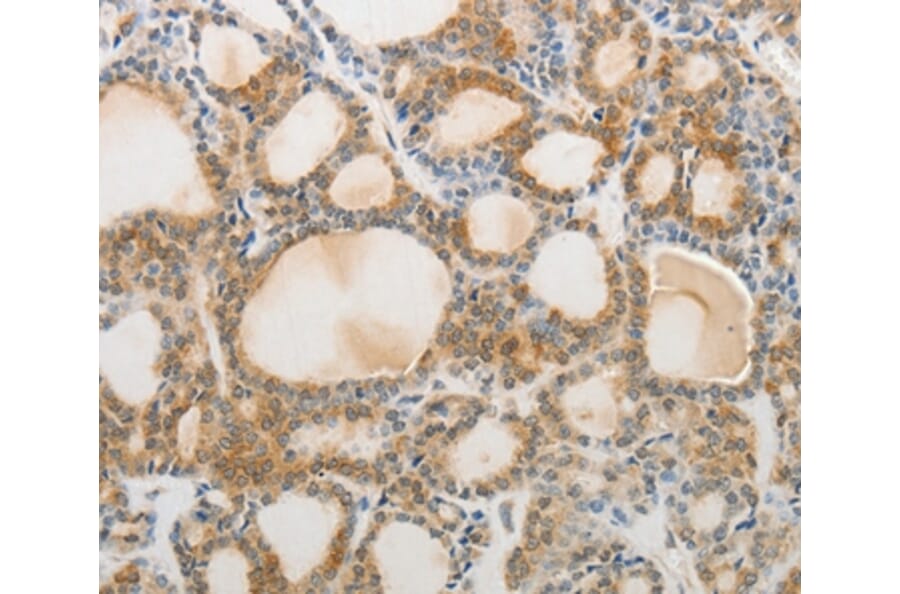 Immunohistochemistry - AKAP1 Antibody from Signalway Antibody (37094) - Antibodies.com
